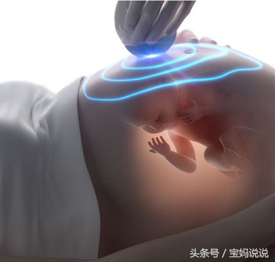 孕期“绝不能少”四次彩超检查你知道吗？让超声科大夫告诉你……