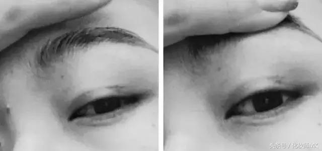 真实贴双眼皮贴,单眼皮怎么贴第二天变双眼皮