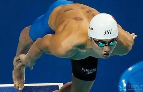 拔火罐内马尔,内马尔拔火罐视频大全