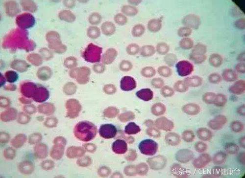 钻胯治病9元一次这样的奇耻大辱真的能治好白血病吗？