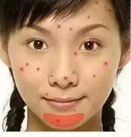 脸的侧面为什么长一些小痘痘,为什么额头上长了好多痘痘