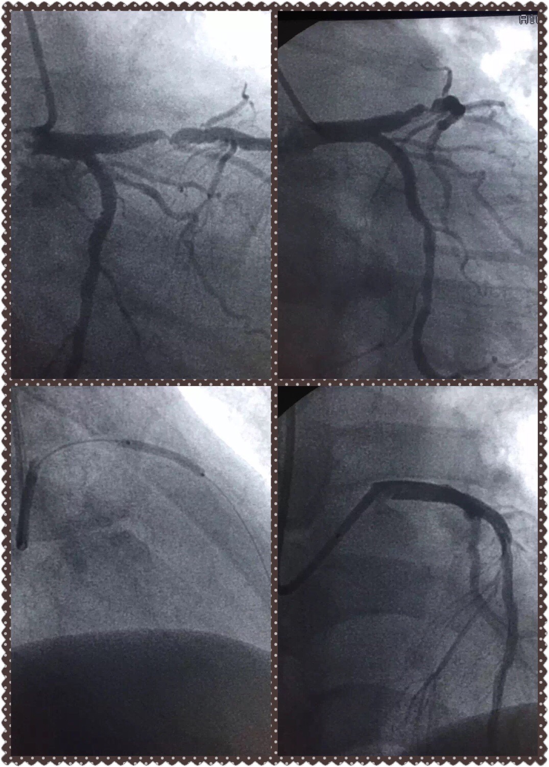 医生有没有权力抓病人,医生有拒绝患者住院的权利吗