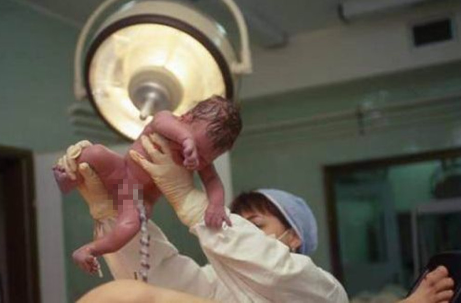 孩子生出来脐带一直不剪会窒息,孩子出生胎盘出来前剪脐带吗