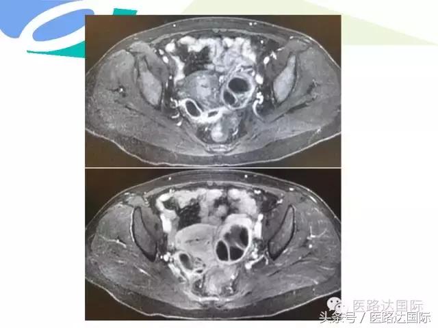北京妇产医院梁宇霆,北京妇产医院梁宇霆出诊