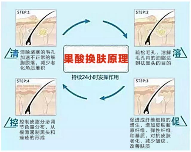 ordinary30%果酸脸上有痘痘可以用吗,果酸对脸上的痘有用吗