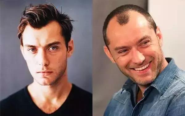 有一种忧伤叫做忘记,有一种忧伤是什么