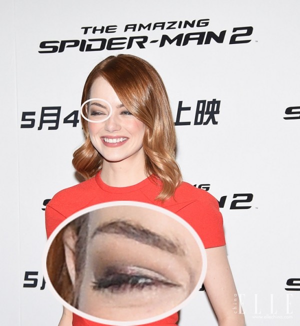 双眼皮100种整形图解,双眼皮整形全程讲解