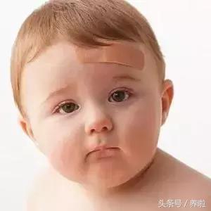 宝宝磕碰容易淤青怎么回事,宝宝磕碰肿淤青怎么处理