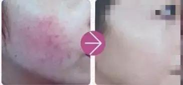 如何去除红痕,怎么去除红颜料