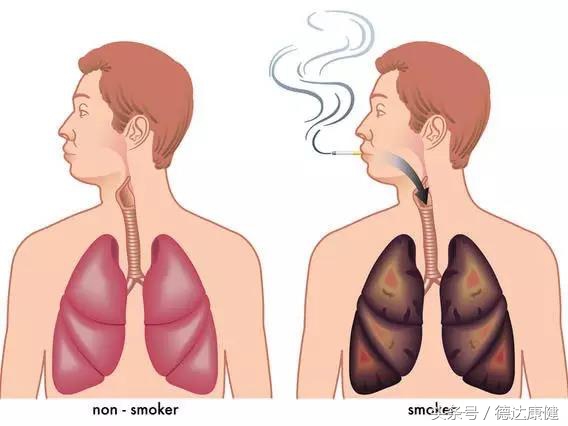 慢阻肺患者管理实施方案,慢阻肺的自我管理微视频