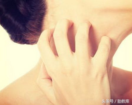 剖宫产刀口贴胶带好痒,剖宫产手术20天刀口特别痒