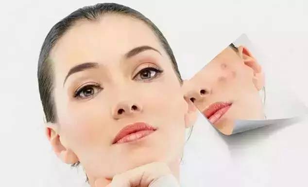 大美人祛斑美白,大美人祛痘