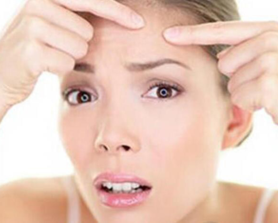 为什么来姨妈会长痘痘,为什么额头会长痘痘