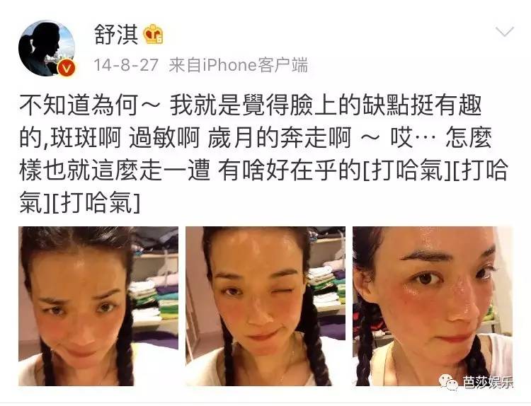 舒淇过敏发作视频,舒淇过敏