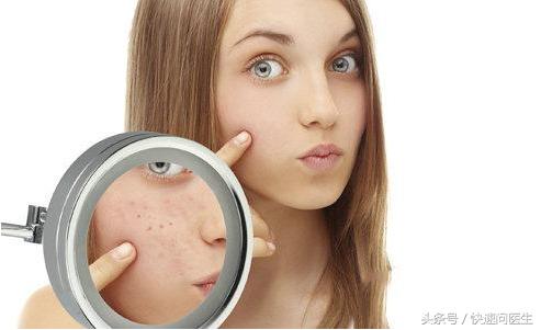 激光祛痘印的危害与效果,激光快速祛黑痘印