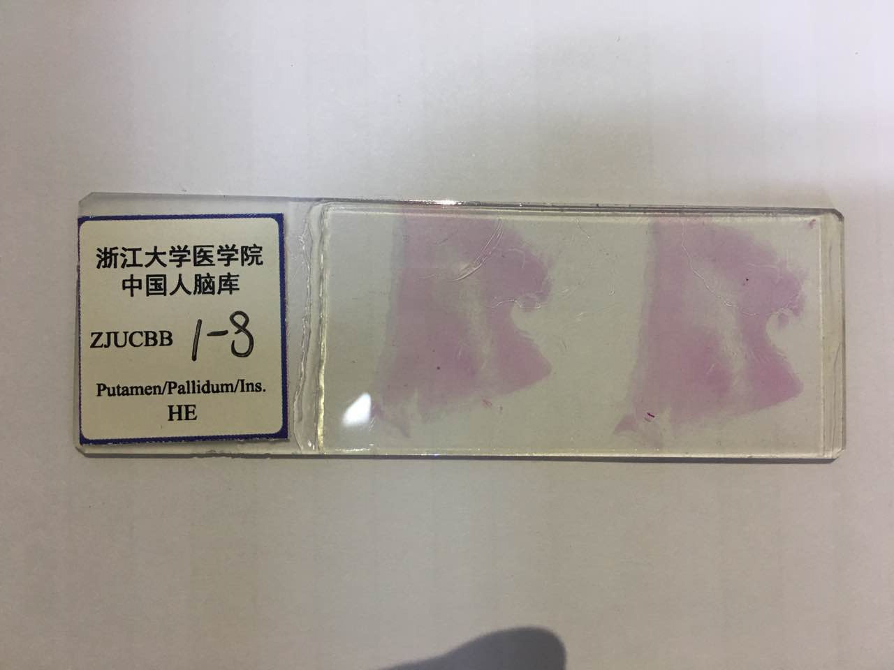 你有考虑过将来捐献器官救人吗,陈天桥为什么执着脑科学研究