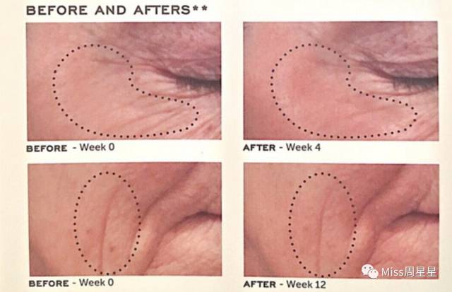 提拉紧致美容仪评测 (紧致提拉美容仪到底有没有用)