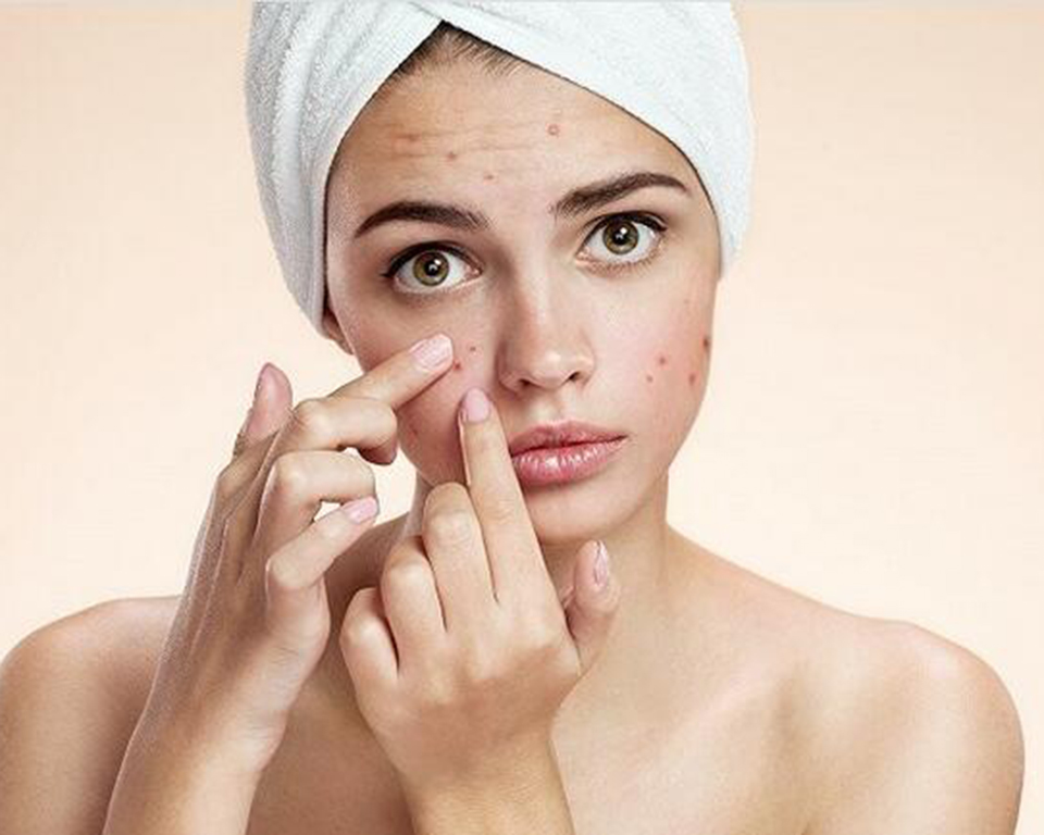 脸上长痘痘怎么快速消除,脸上的痘痘变成疮怎么办