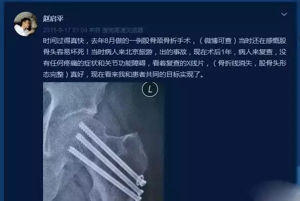 女朋友肠胃不舒服怎么办？按《欢乐颂》的教程绝对让你散伙！