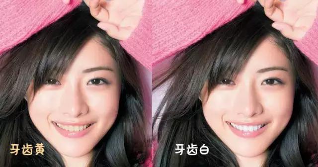 拥有一口好牙才能算的上完美，终极美白牙齿的攻略在这里！