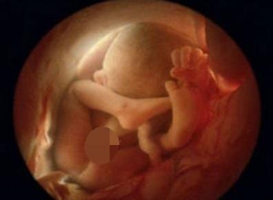 孕妇五个月见红着急去医院么,孕五个月见红医生开了止血保胎药