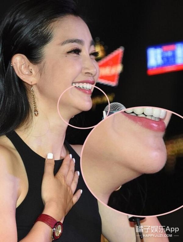 林心如和陈乔恩对比,陈乔恩柳岩瘦脸