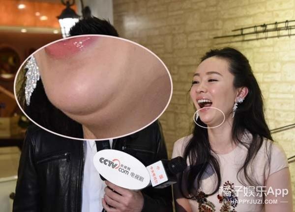 林心如和陈乔恩对比,陈乔恩柳岩瘦脸