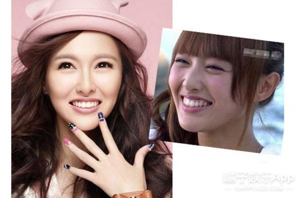 笑容引起的法令纹怎么解决,怎么样的笑容可以改善法令纹