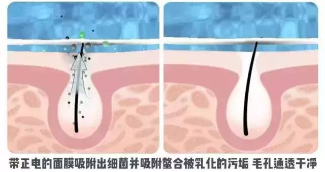 丘疹痘痘的症状和原因,青春期痘痘的症状和治疗方法