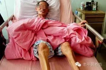 蛋白质能量营养不良病因有哪些,营养治疗是疾病的最终解决方案