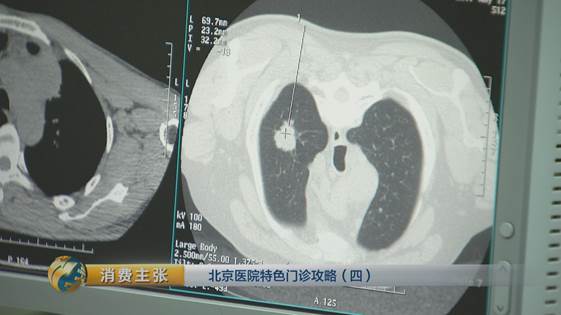 北京中医药专治肺结节的权威医院,治疗肺结节医院前十名