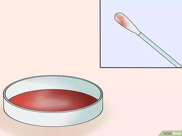 如何判断咽喉炎是不是细菌性感染,抗链球菌高引起的咽喉炎怎么治疗