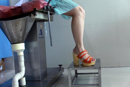 五十天做的无痛人流需要休息几天,无痛人流手术后应该卧床休息几天