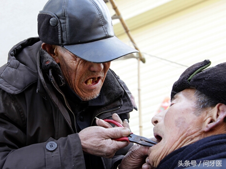 拔牙后出血不止怎么处理,服用抗凝药拔牙出血不止怎么处理