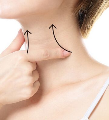 颈纹和胸纹怎么去除,颈纹和脸上的细纹做什么美容项目