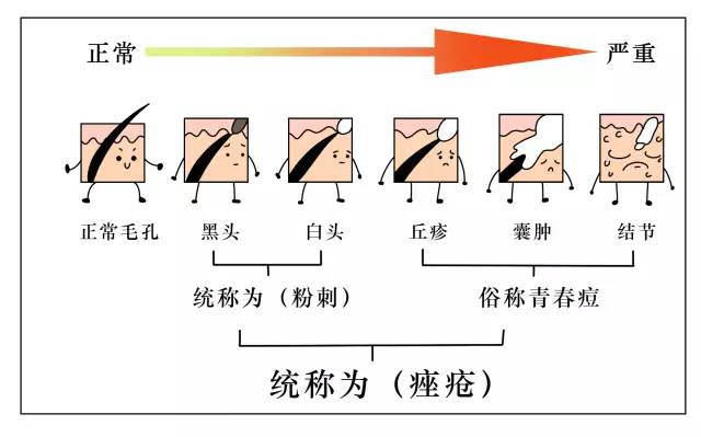 这可能是夏天穿吊带最大的烦恼……这可能是背部痘痘最全攻略