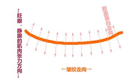 因为爱笑眼角皱纹比较多怎么办,爱笑的女孩有笑纹怎么办