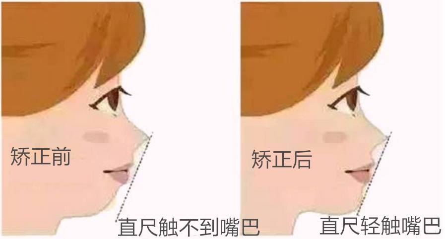 怎么看宝宝牙齿长好了没,宝宝牙齿有哪种方法能保持好