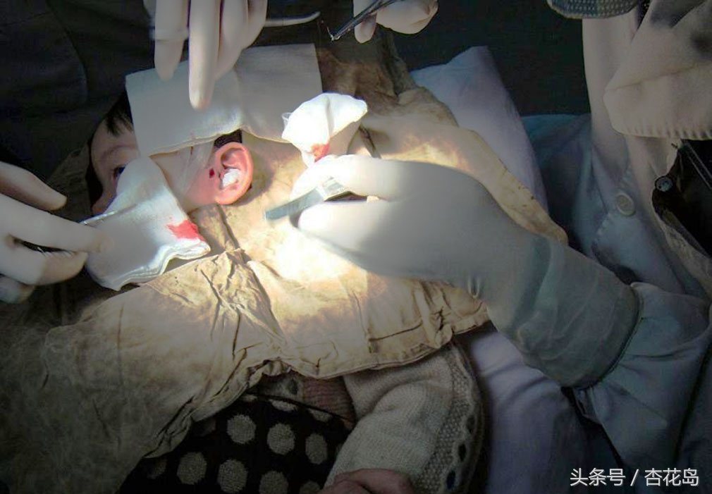 长小耳朵是怎么回事,长小耳朵什么意思