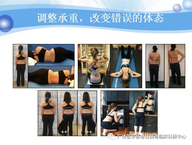 脊柱侧弯暑期训练营招募,脊柱侧弯夏令营视频