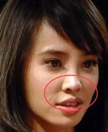 听说爱笑的女孩子法令纹都很深,爱笑的女孩真的容易得法令纹吗