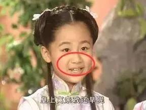 听说有法令纹的女孩子都很爱笑,爱笑的女生法令纹都不会太浅