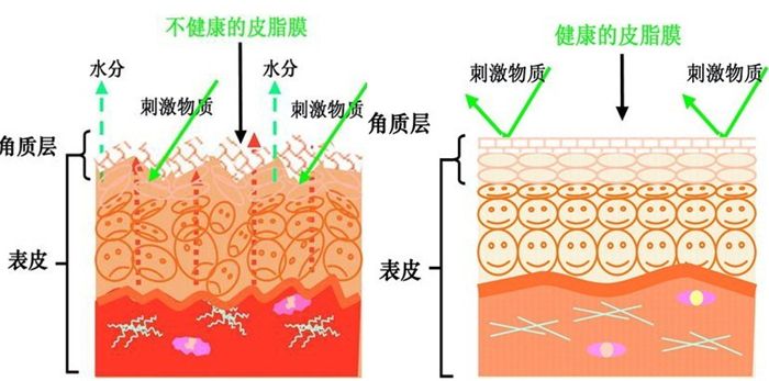 怎样判断自己是不是激素脸,如何判断激素脸和过敏脸