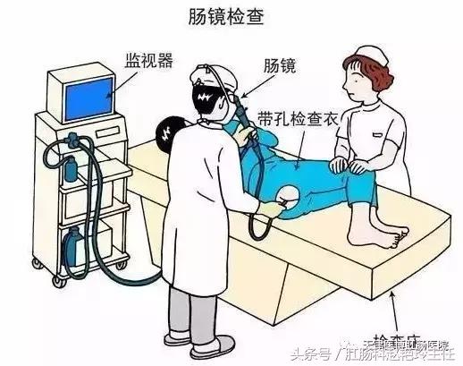 肠镜检查流程和注意事项,肠镜检查如何做