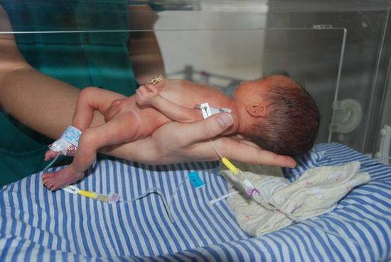 孕妇34周宫缩频繁保胎能保住吗,怀孕宫缩剧烈疼痛还坚持上班