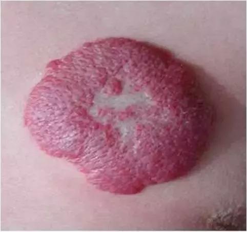 儿保体检有多坑,儿保体检准确么