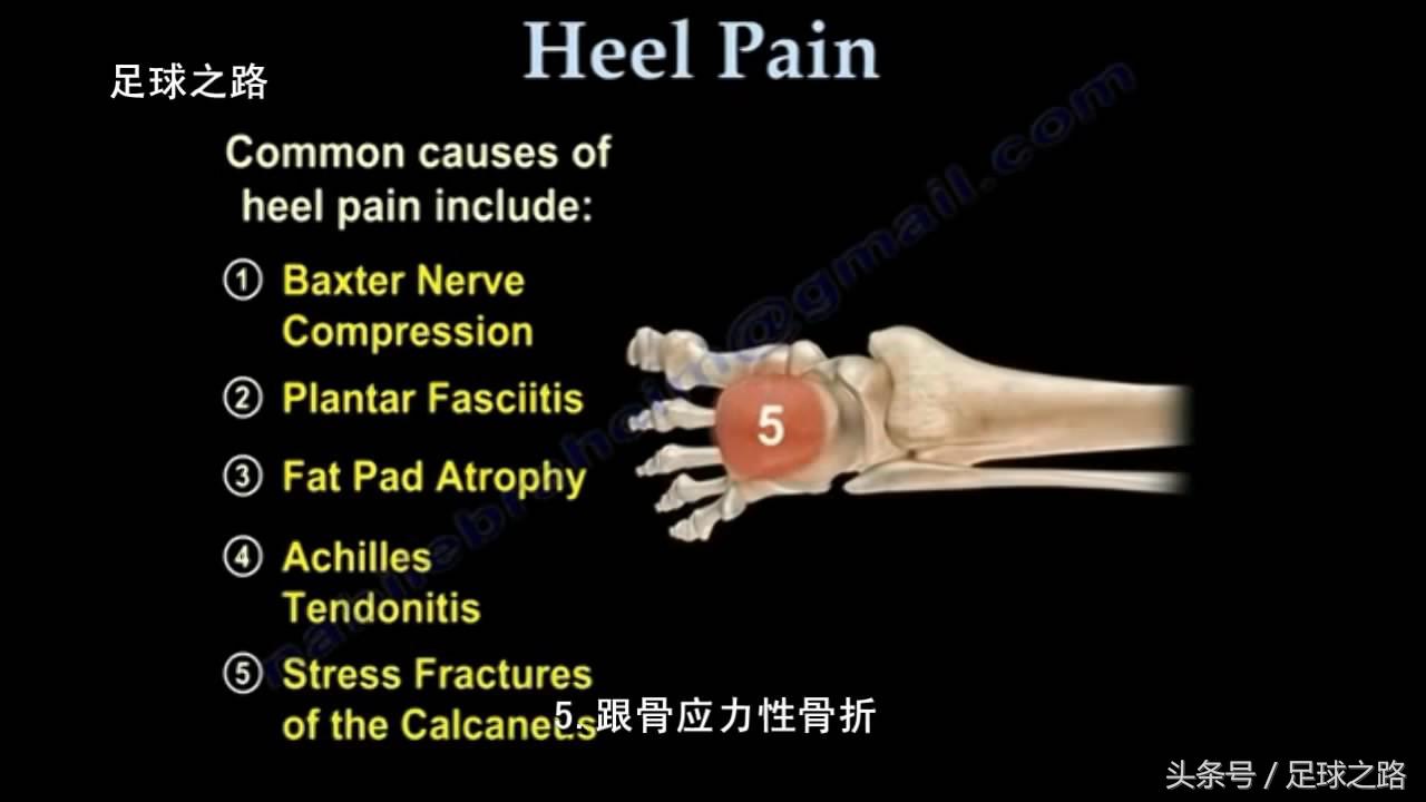 足跟痛的症状及表现,足跟痛最常见病因