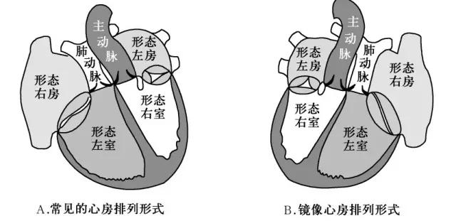 超声肺动脉瓣示意图,肺动脉左右分支超声视频
