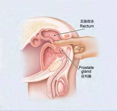 父母体检查什么？医生开的这个最全体检清单，你一定用得上！
