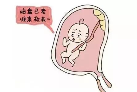 胎盘三级还有多久分娩,胎盘三级是不是表示宝宝快出生了